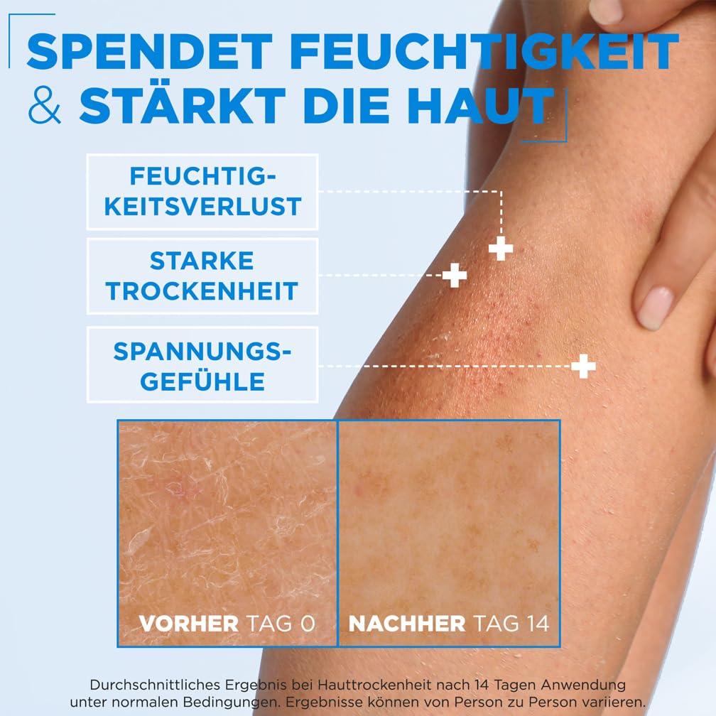 61XkQ3W5r5L._SL1008_